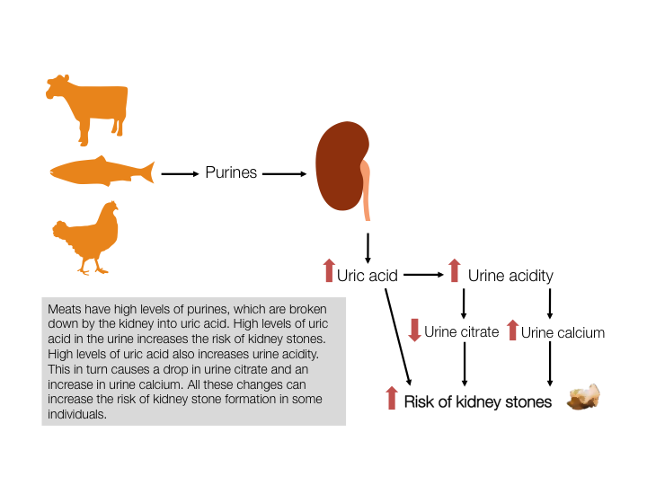 What foods should you avoid to prevent kidney stones?