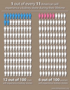 Infographic of how common kidney stones are in the United States