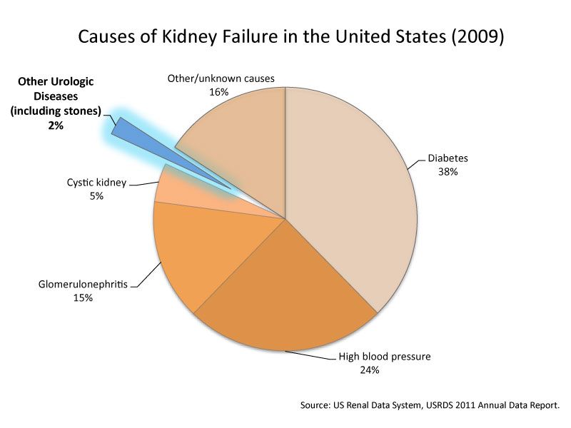 can-kidney-stones-cause-kidney-failure-or-damage-kidneystoners