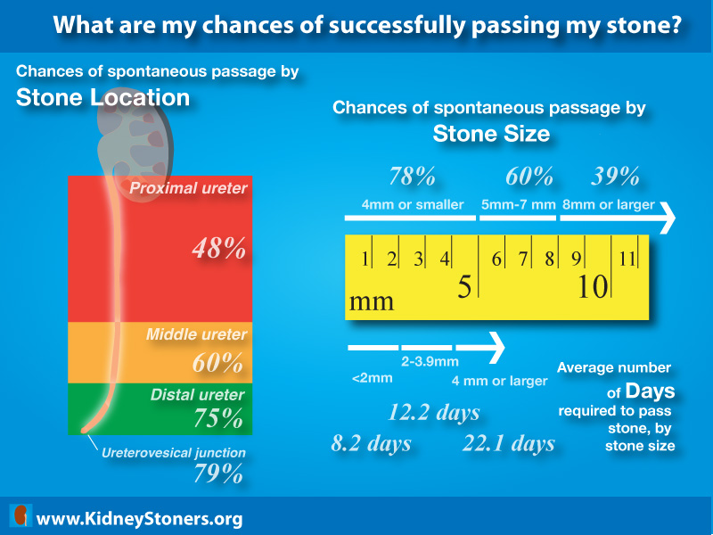 Kidney Stone Chart Size