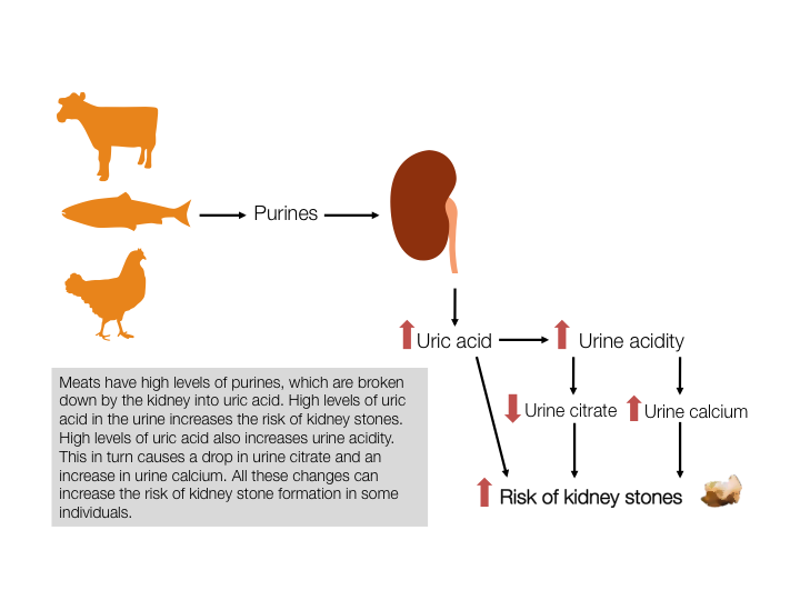 meat intake and kidney stones
